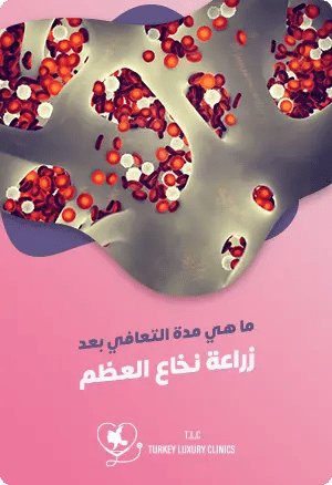 ما هي مدة التعافي بعد زراعة نخاع العظمfeatured image