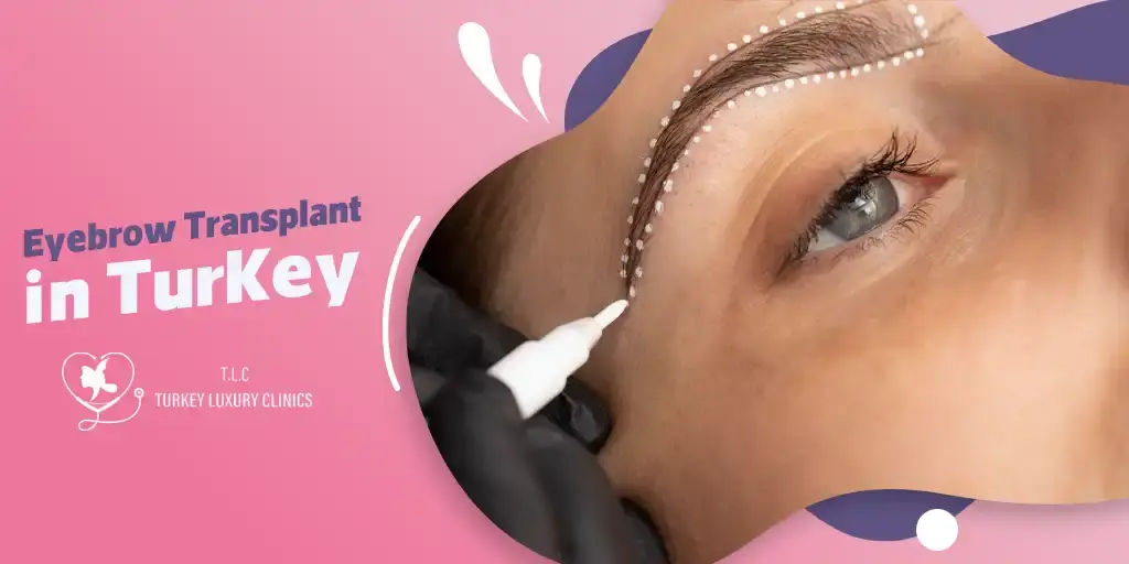 Eyebrow Transplant in Turkey: Fuller, Natural Brows