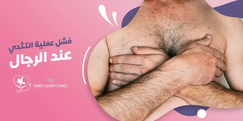 فشل عملية التثدي عند الرجال