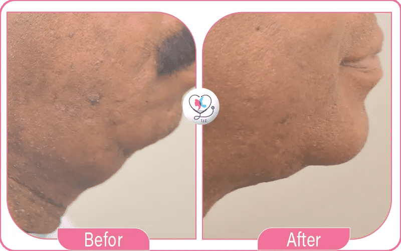 أولاً: خالد و"تجربتي مع شد اللغلوغ"