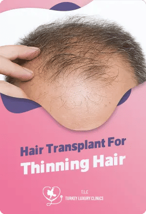 Hair Transplant For Thinning Hair