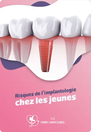 Risques de l'implantologie chez les jeunes