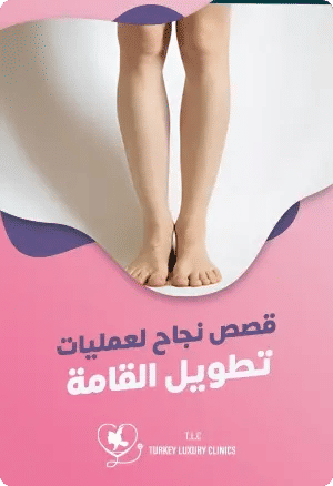 قصص نجاح لعمليات تطويل القامةfeatured image