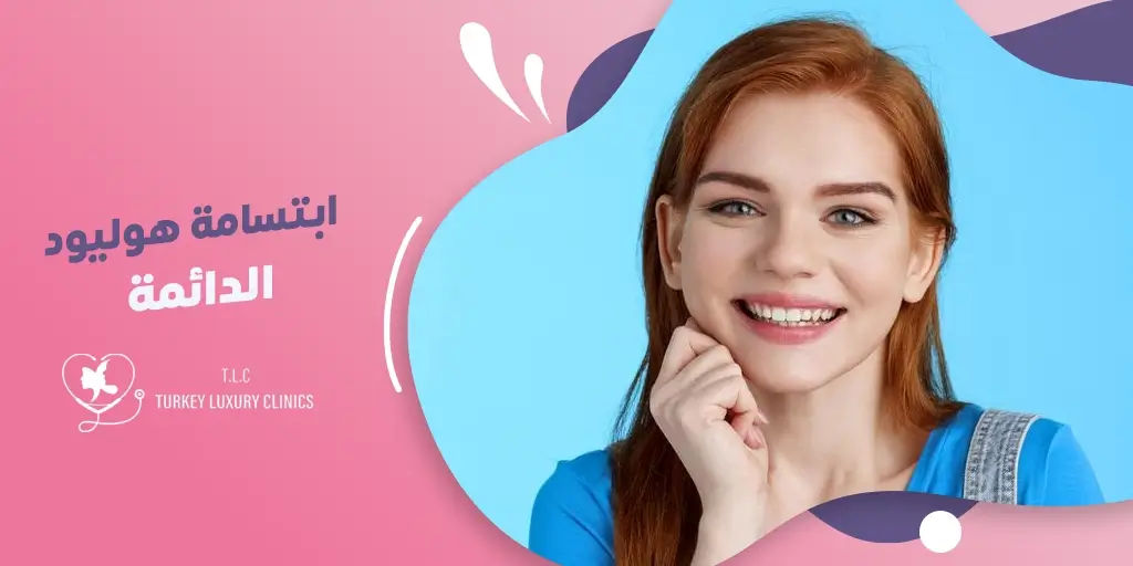 ابتسامة هوليود الدائمة