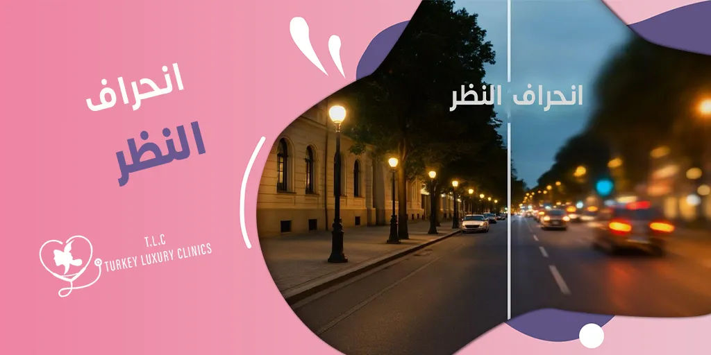 انحراف النظر: الأسباب والأعراض وطرق العلاج المختلفة