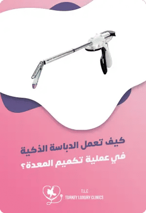 كيف تعمل الدباسة الذكية في عملية تكميم المعدة؟