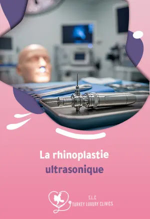 La rhinoplastie ultrasonique : Guide complet