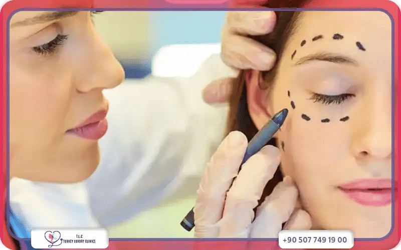 تكلفة عملية شد الجفون في تركيا