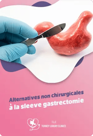 Alternatives non chirurgicales à la sleeve gastrectomiefeatured image