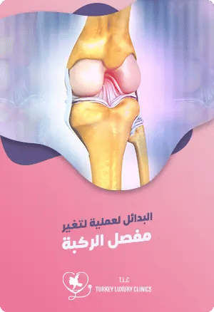بديل عملية تغيير مفصل الركبة في تركياfeatured image
