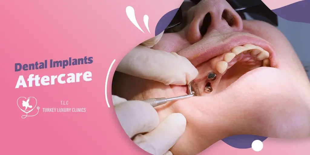Dental Implant Aftercare: Your Guide to a Speedy Recovery