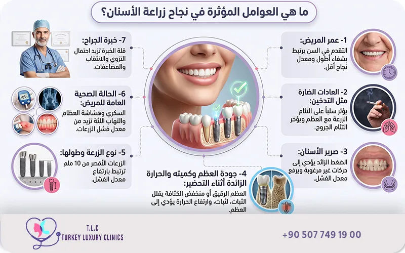 ما هي العوامل المؤثرة في نجاح زراعة الأسنان