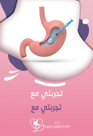 تجربتي مع بوتكس المعدة: حقن المعدةfeatured image