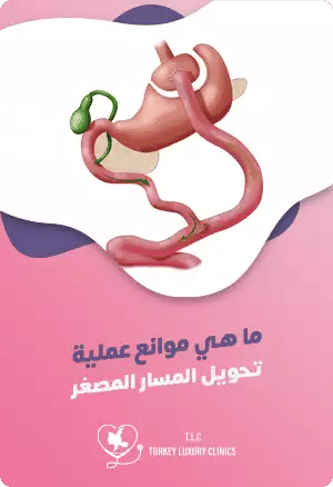 ما هي موانع عملية تحويل المسار المصغر؟featured image