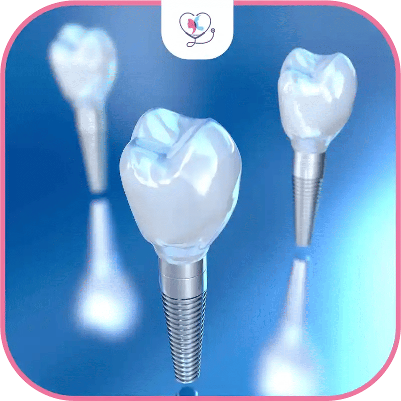 allergies aux matériaux d'implants