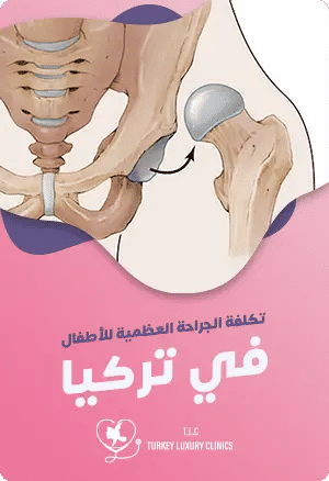 كم تبلغ تكلفة جراحة العظام للأطفال في تركيا؟