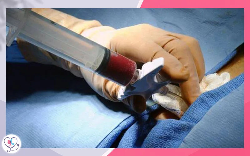 طرق العلاج بعد فشل زراعة نخاع العظم
