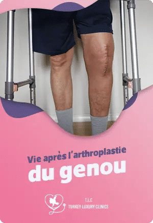 La vie après l'arthroplastie du genoufeatured image