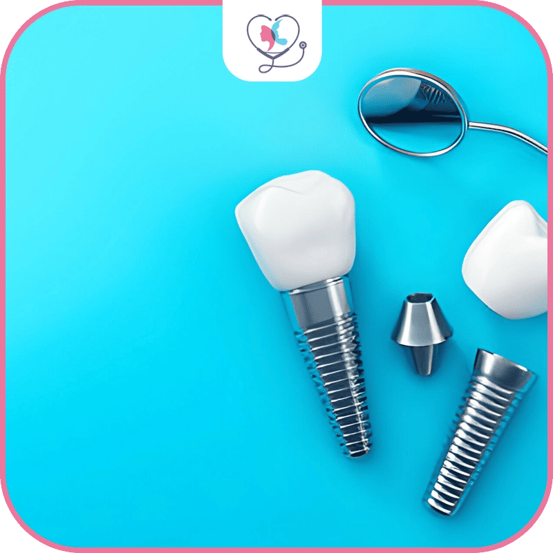 implant dentaire durée de vie
