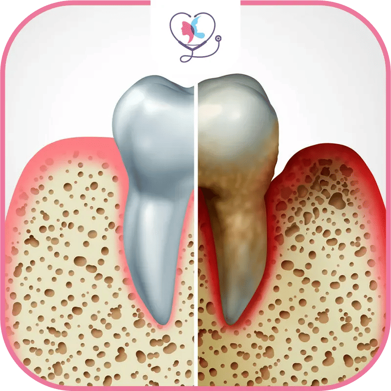 causes des dents decolorees