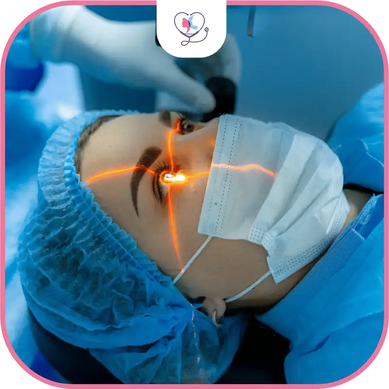 تكلفة عملية الليزك في مختلف الدول