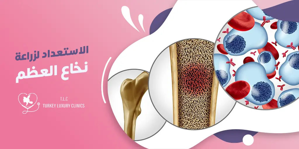 الاستعداد لزراعة نخاع العظم