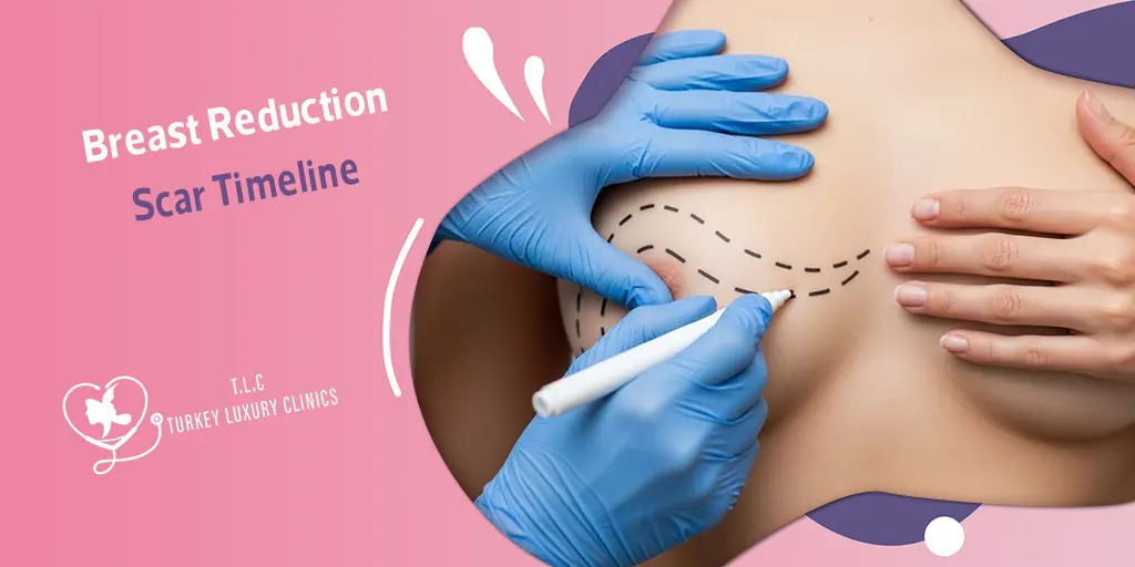Breast Reduction Scar Timeline: Here's What to Expect