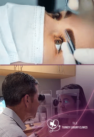 PRK vs ICL: Which Vision Correction Procedure Is Better?