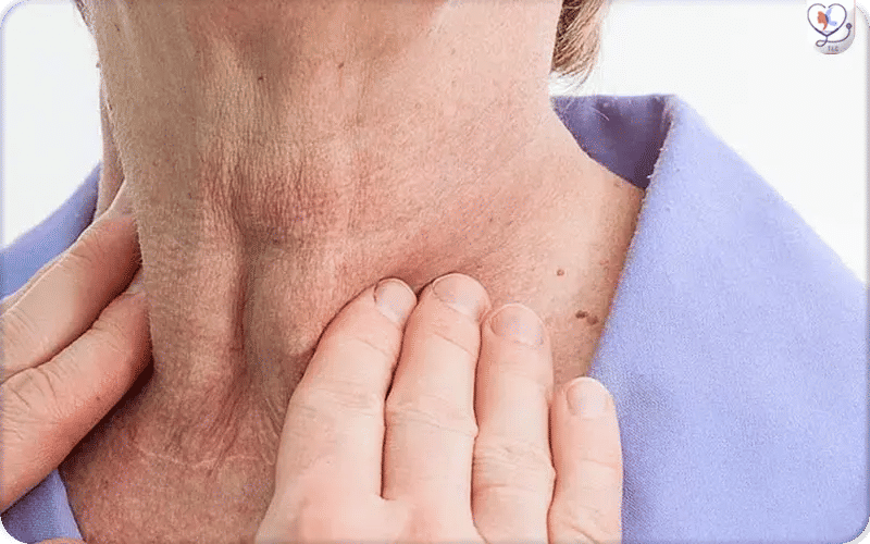أعراض التهاب الغدة الدرقية عند النساء