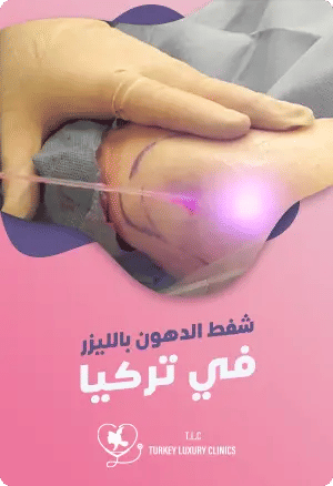 شفط الدهون بالليزر في تركيا:دليلك الشامل