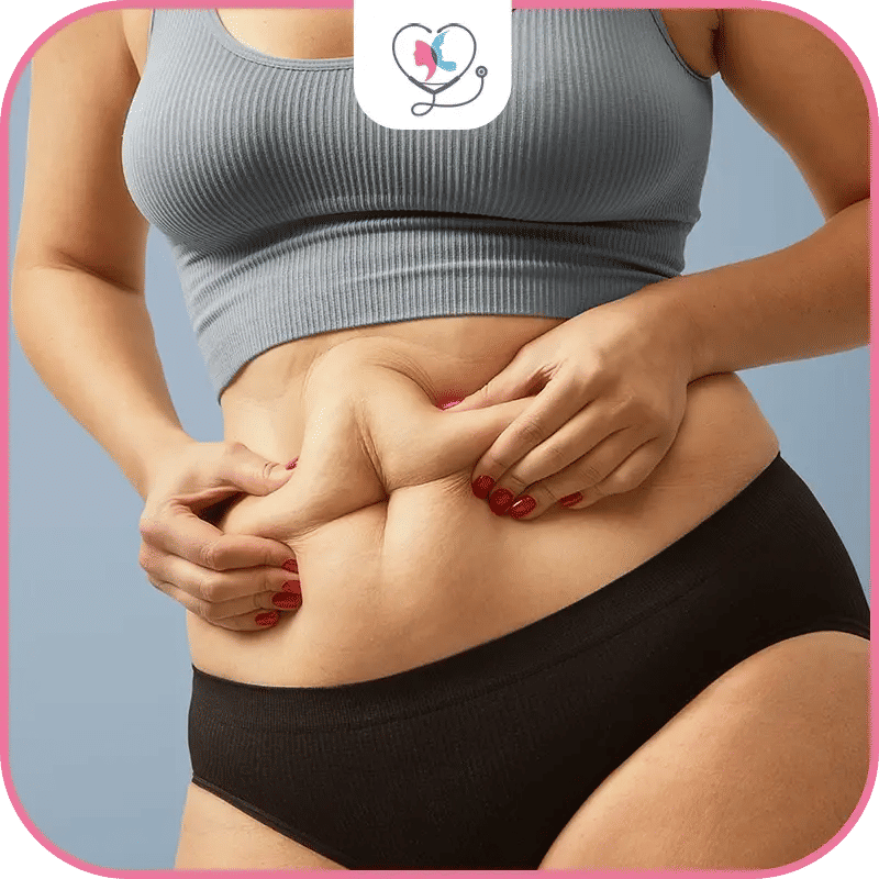 liposuccion abdominale prix - liposuccion ventre avant après