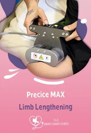 Precice MAX Beinverlängerung: Kosten, Vorteile & Sicherheitfeatured image