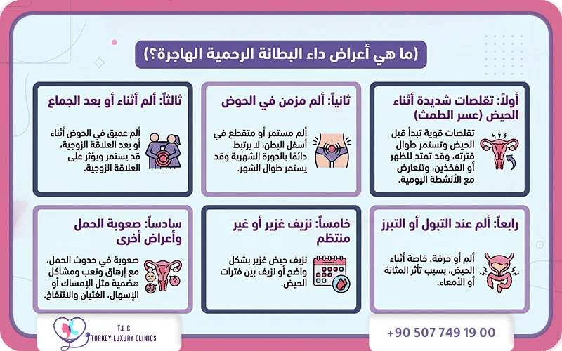 ما هي اعراض بطانة الرحم المهاجرة؟