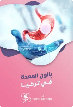 بالون المعدة في تركياfeatured image