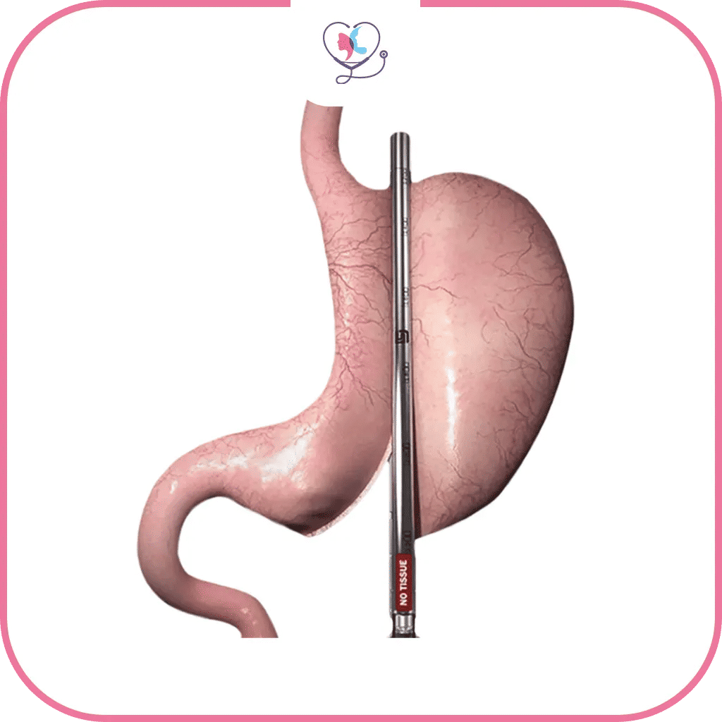 الدباسة الذكية