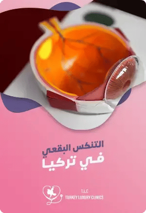 جراحة التنكس البقعي في تركياfeatured image