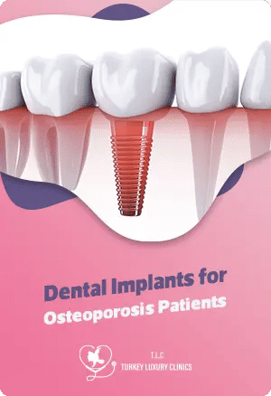 Dental Implants for Osteoporosis Patients