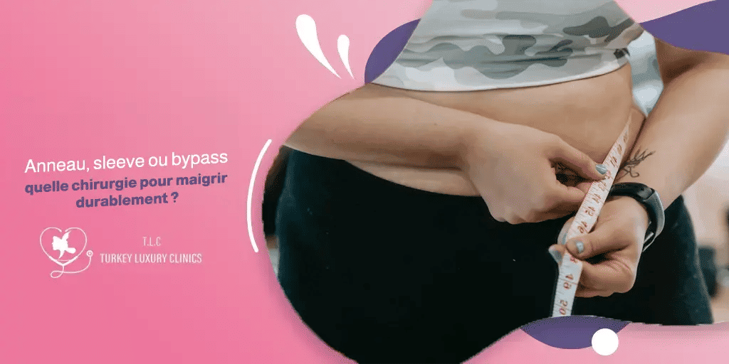 Anneau, sleeve ou bypass : quelle chirurgie pour maigrir durablement ?