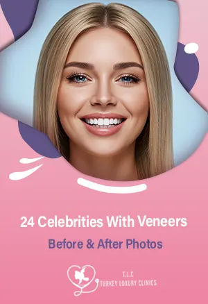 24 Celebrities With Veneers Before & After Photos