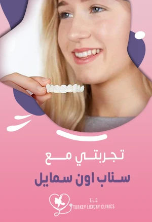 تجربتي مع سناب اون سمايل: المزايا والعيوب وصور حقيقية