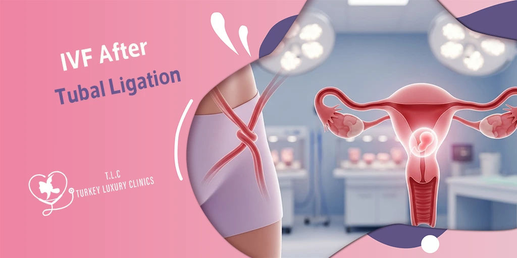IVF After Tubal Ligation: Success Rates and Chances of Pregnancy