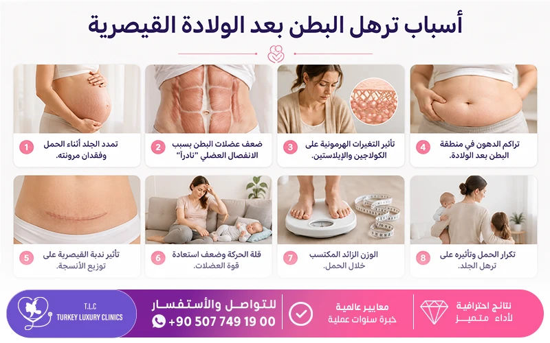 أسباب ترهل البطن بعد الولادة القيصرية