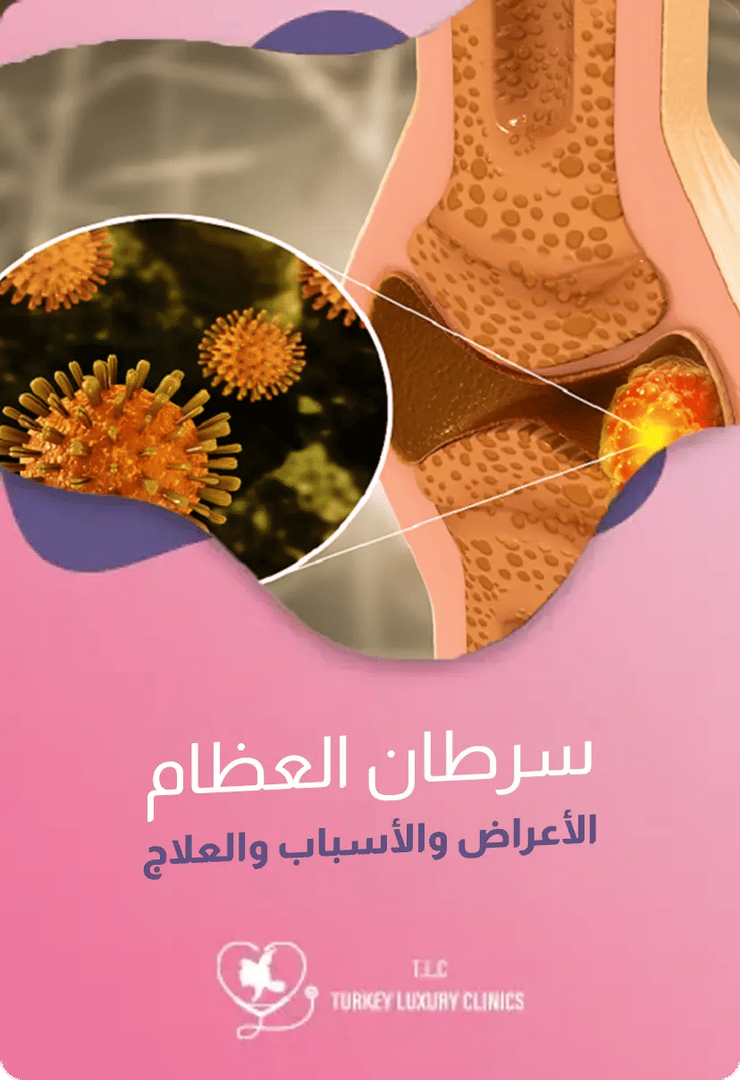 كم يعيش مريض سرطان العظام: المراحل والعلاج ونسبة الشفاء