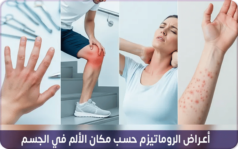أعراض الروماتيزم حسب مكان الألم في الجسم