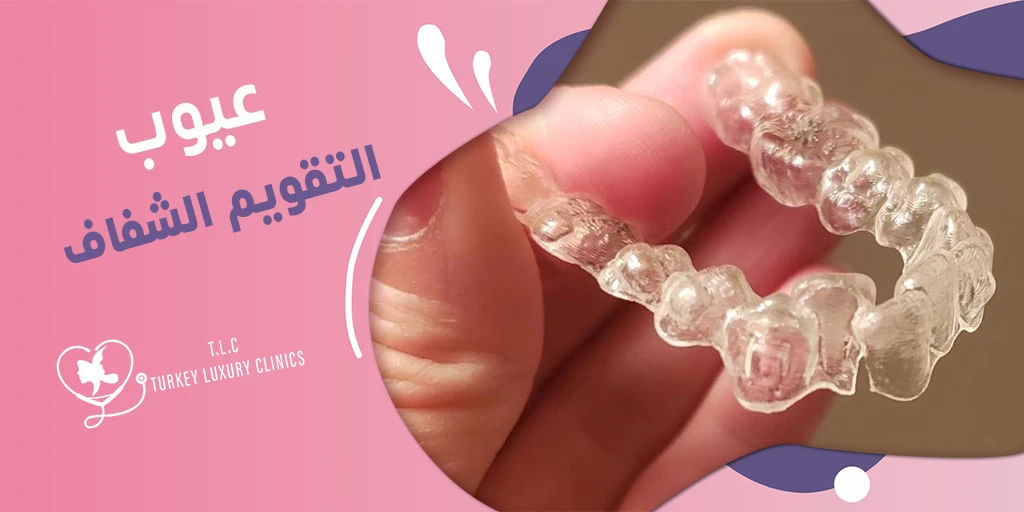 عيوب التقويم الشفاف: 6 عيوب مع نصائح لتفاديها