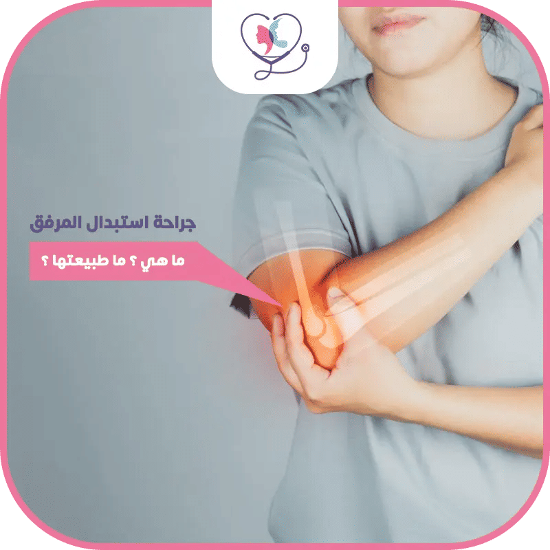 استبدال المرفق في تركيا