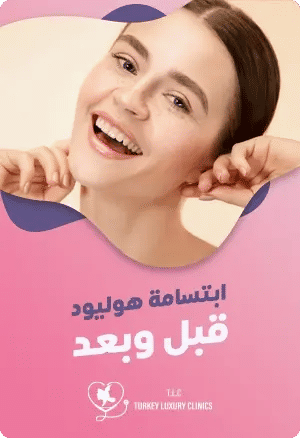 ابتسامة هوليود قبل وبعدfeatured image