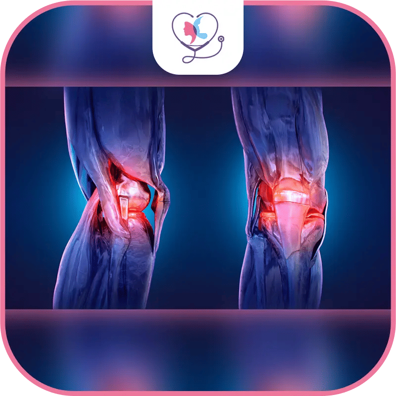 Risques et complications des prothèses du genou-1772045706558