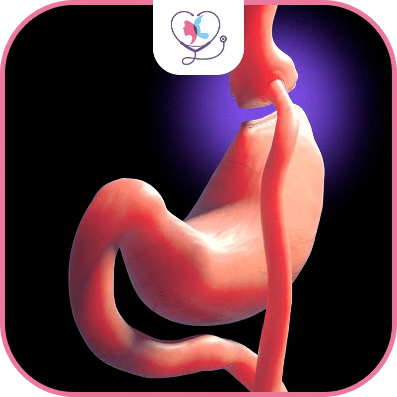 تكلفة عملية تحويل مسار المعدة في تركيا