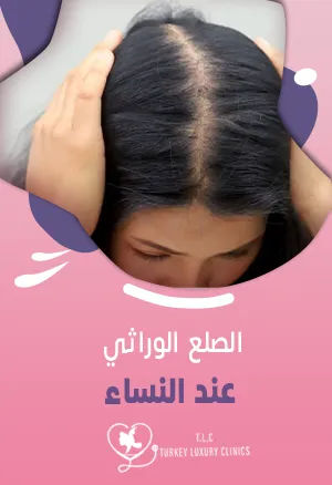 الصلع الوراثي عند النساء: شاهدي علاج حالات حقيقية 100%